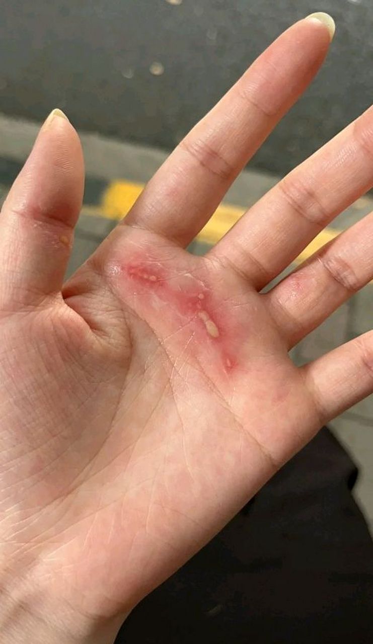 关于为什么没有有一个人敢上去开团啊？全是蛆吗都在后面看？的信息